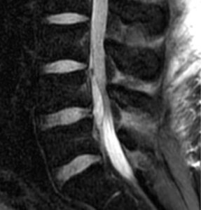 39-year-old man with back pain