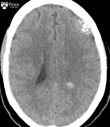 33-year-old woman after motor vehicle collision