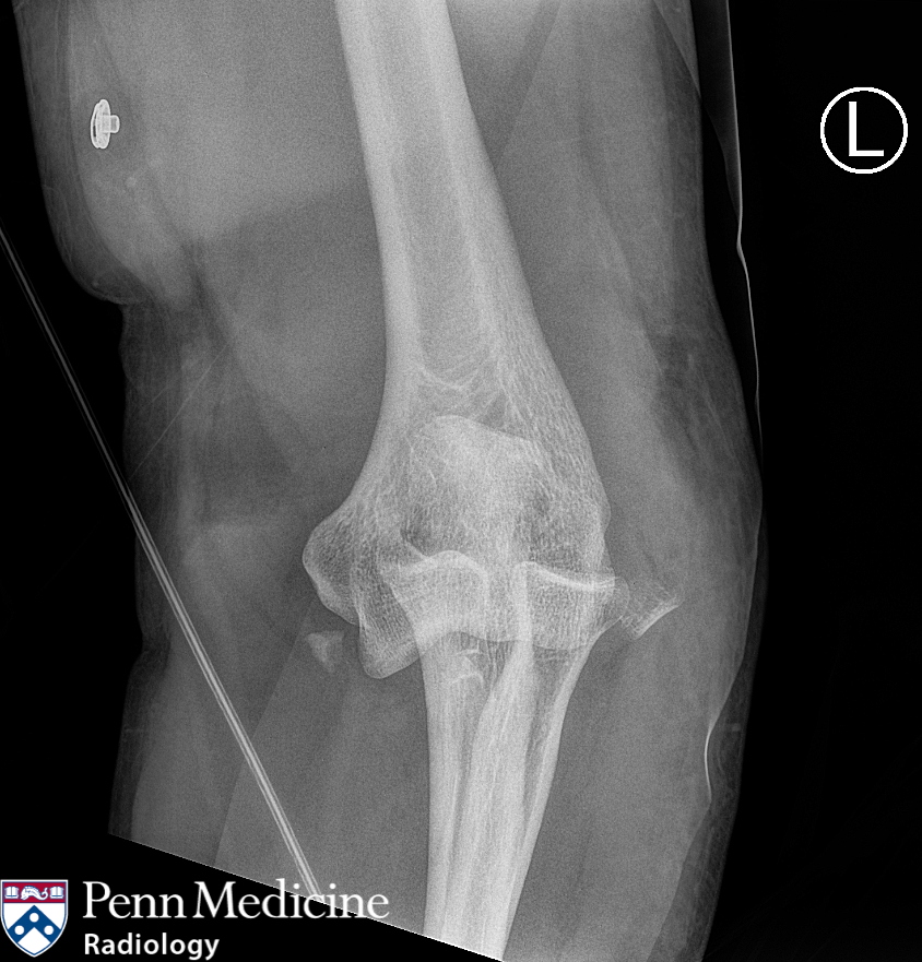 33-year-old man after all-terrain vehicle accident