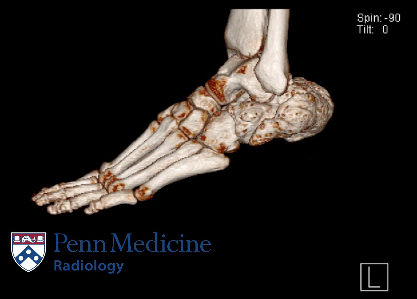 31-year-old with hip and foot pain