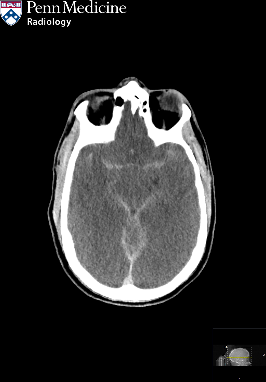 46-year-old man found down