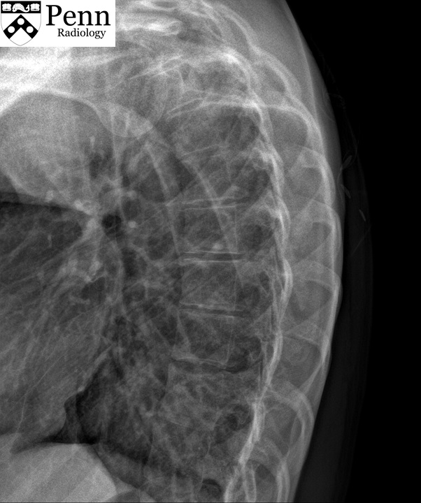 25-year-old woman with chronic back pain