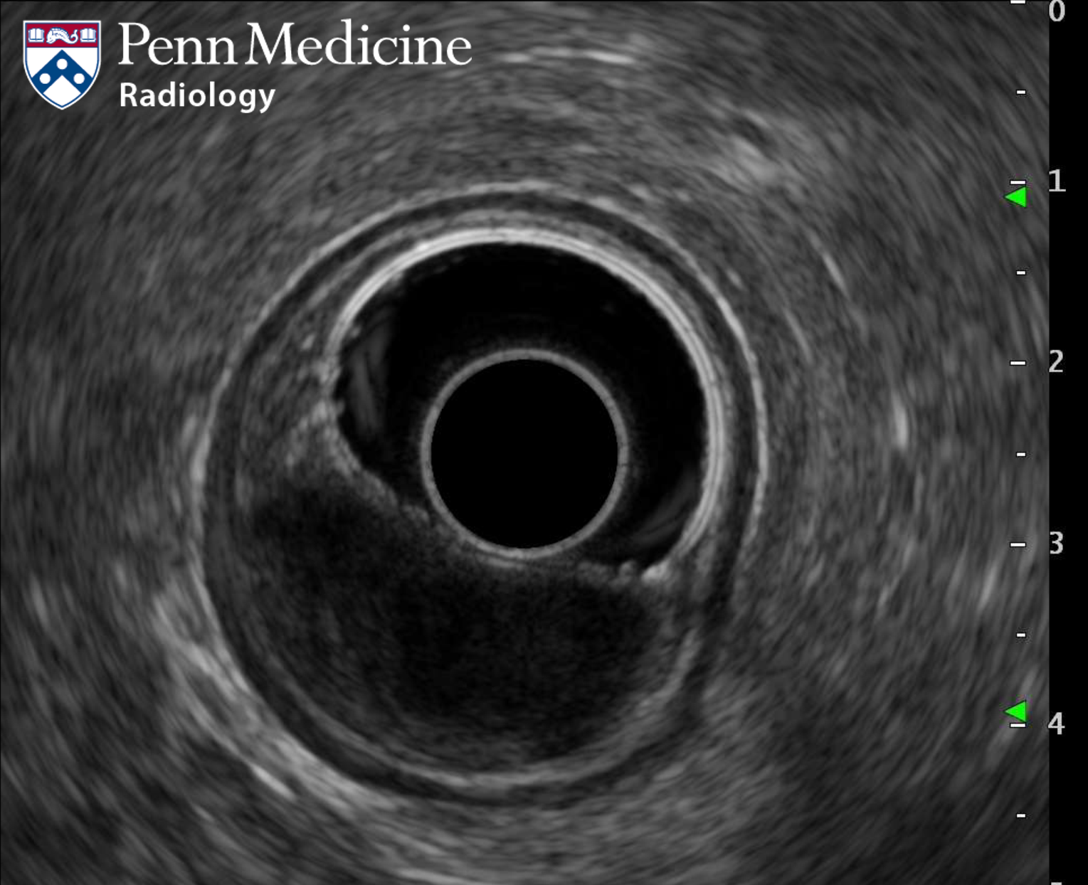48-year-old woman undergoing preoperative evaluation
