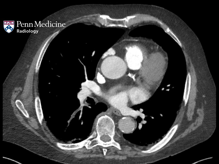 75-year-old male with shortness of breath