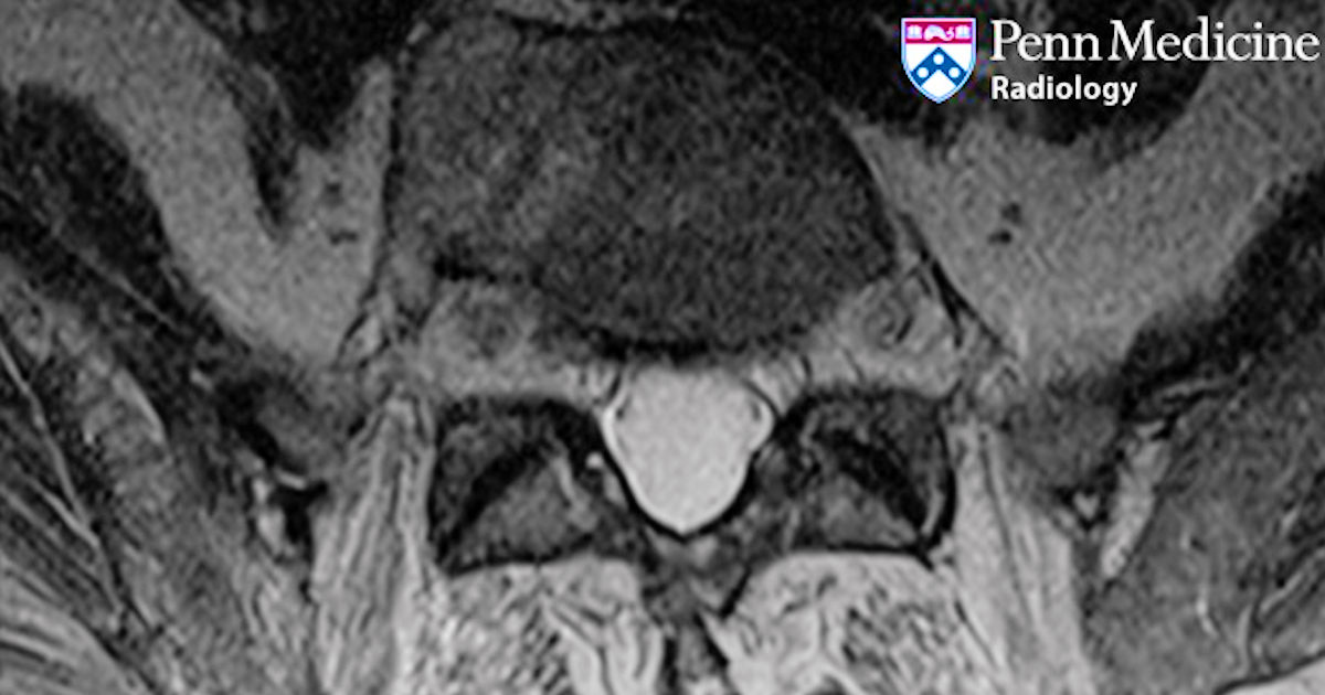78-year-old woman with back and hip pain