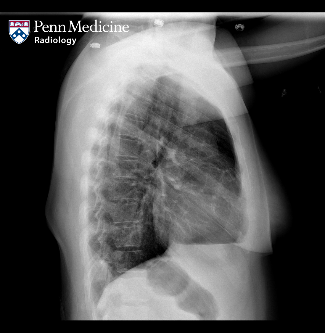 32-year-old woman with shortness of breath