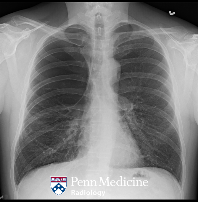 39-year-old man with shortness of breath and cough