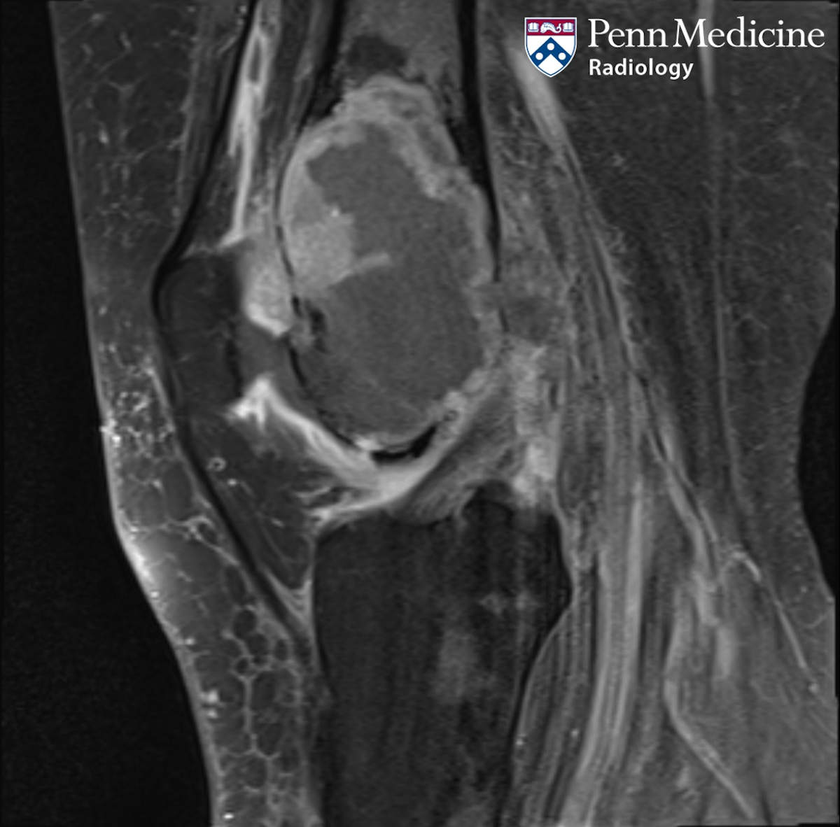 48-year-old woman with knee pain