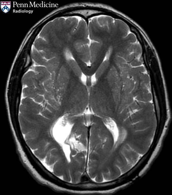 40-year-old man presenting with vision loss