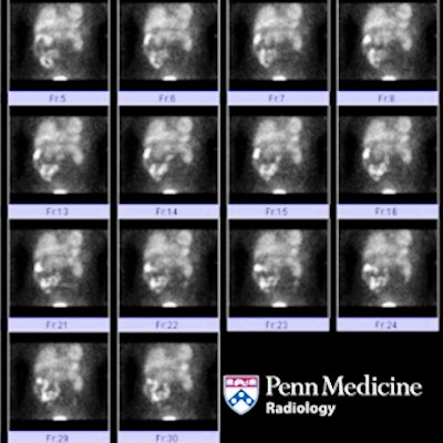 39-year-old woman with right upper quadrant pain and nausea