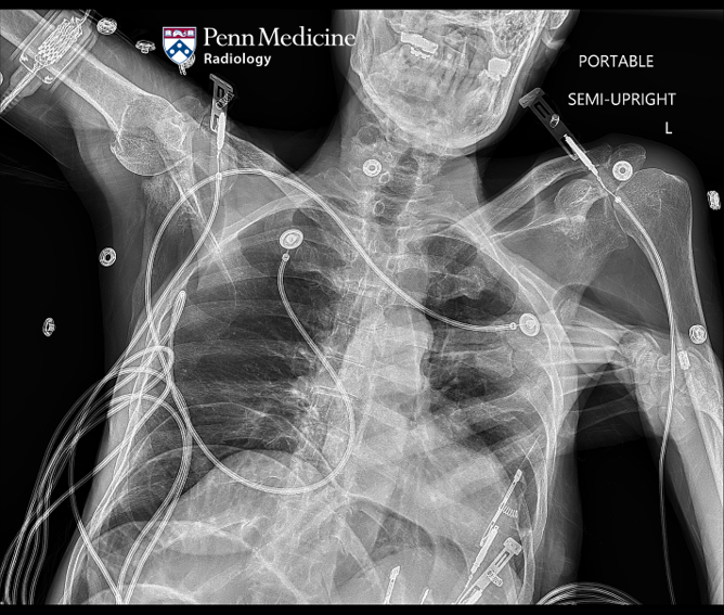 71-year-old woman with altered mental status