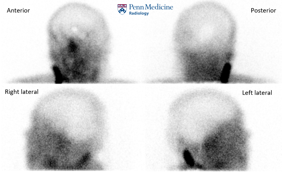 Man of unknown age with gunshot wound to the head