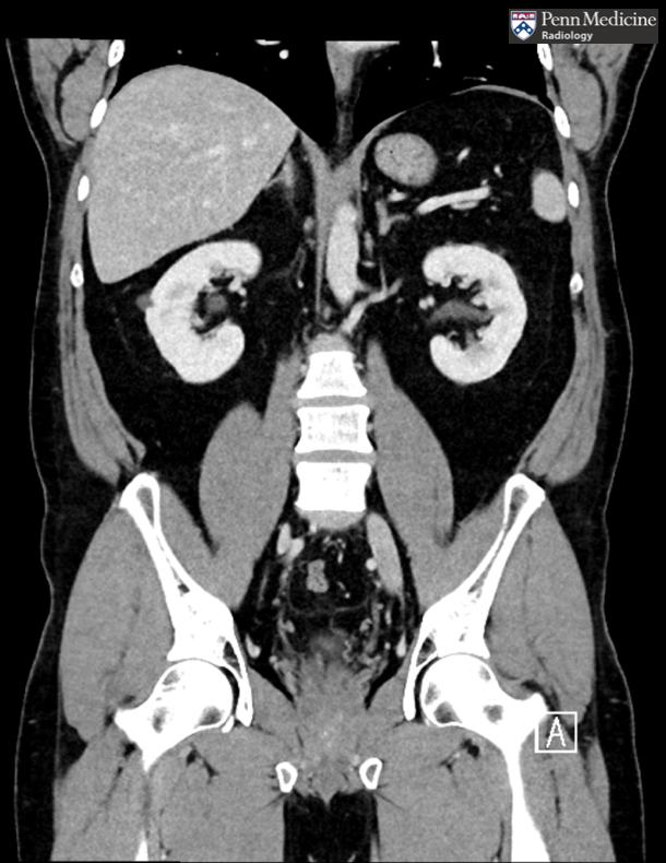 51-year-old man with abdominal pain