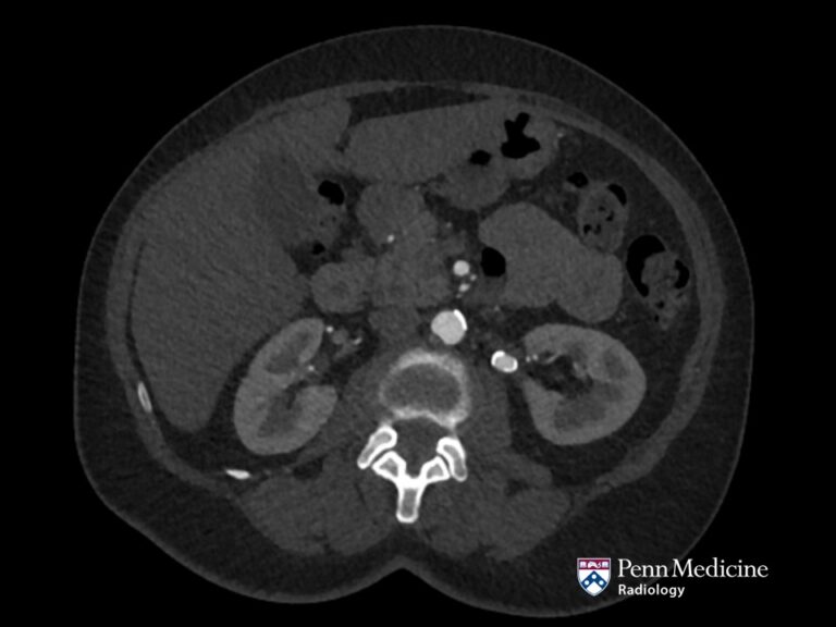 73-year-old woman with back pain