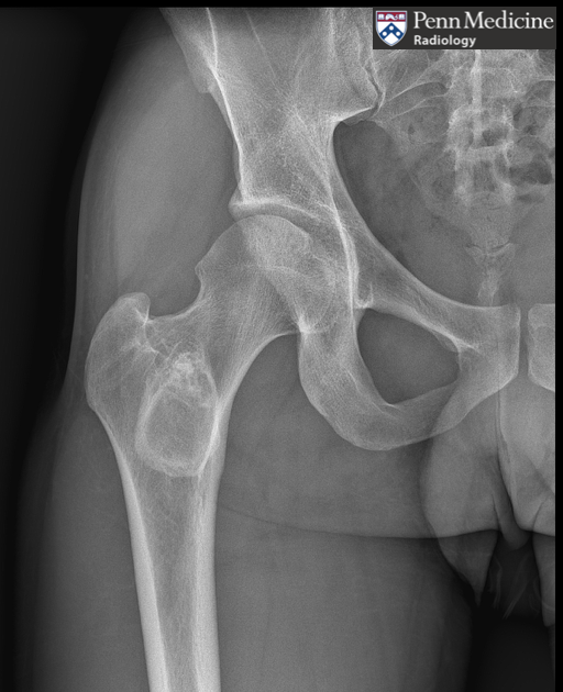32-year-old man with right hip pain