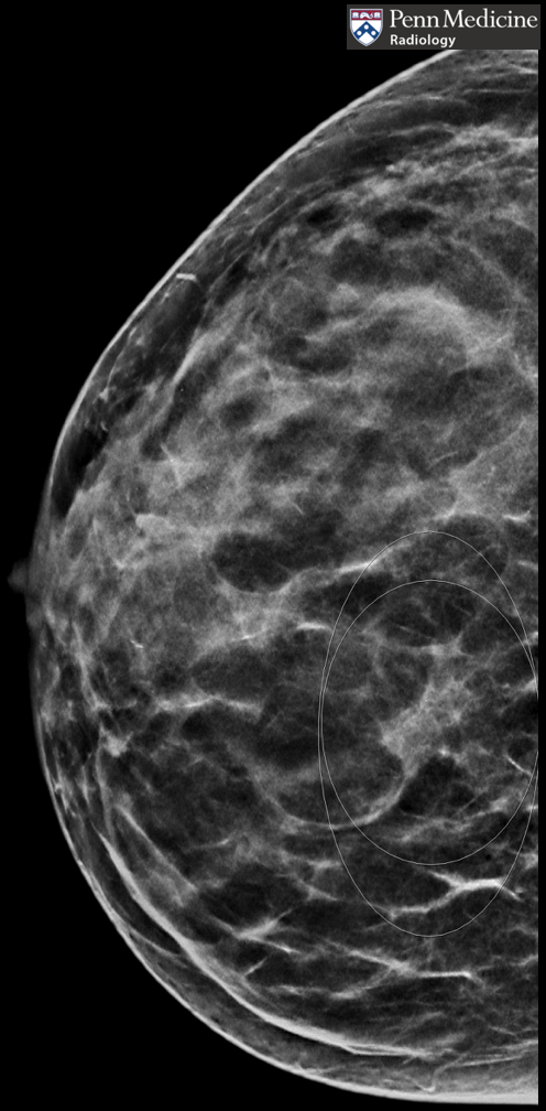 26-year-old woman presents for high-risk screening