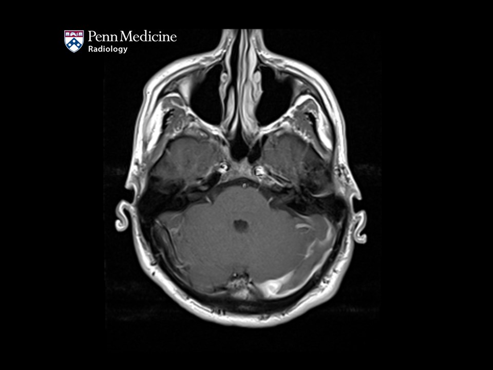 21-year-old man with headache