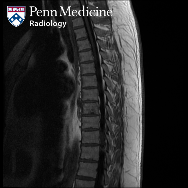 37-year-old man with back pain