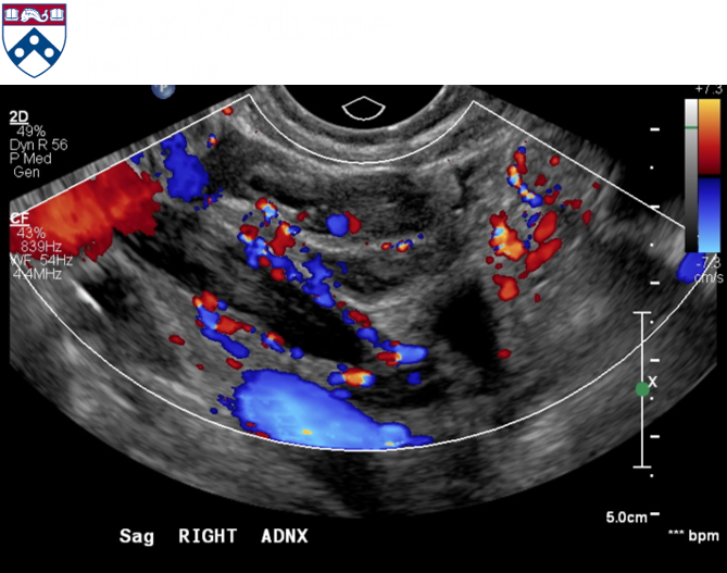 35-year-old woman with acute onset abdominal pain and vomiting