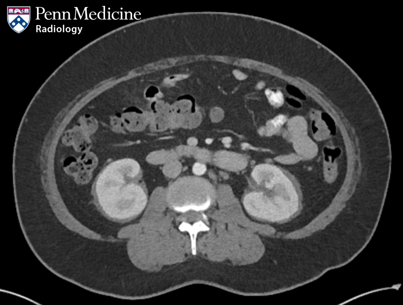 42-year-old man with blurry vision